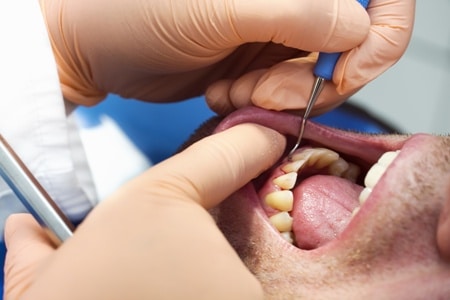 dental treatment male