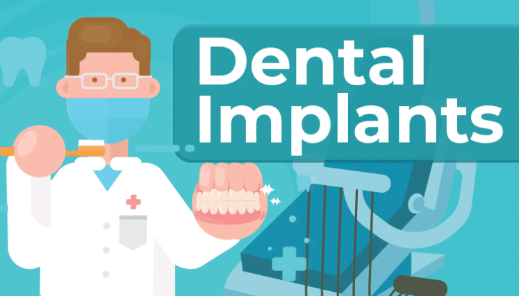 infographic dental implants 5e95bbd6a5833